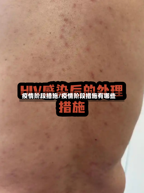 疫情阶段措施/疫情阶段措施有哪些