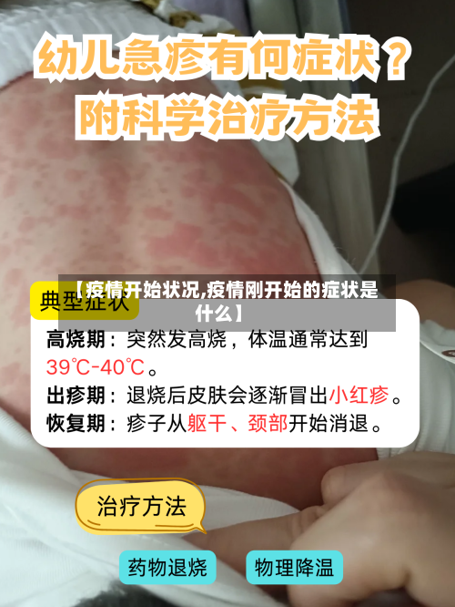 【疫情开始状况,疫情刚开始的症状是什么】