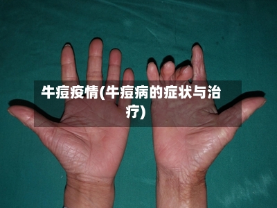 牛痘疫情(牛痘病的症状与治疗)