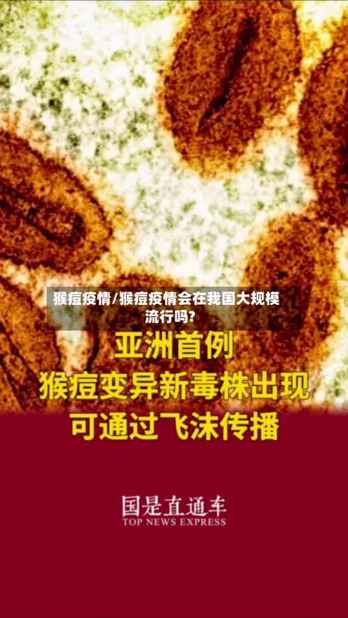 猴痘疫情/猴痘疫情会在我国大规模流行吗?