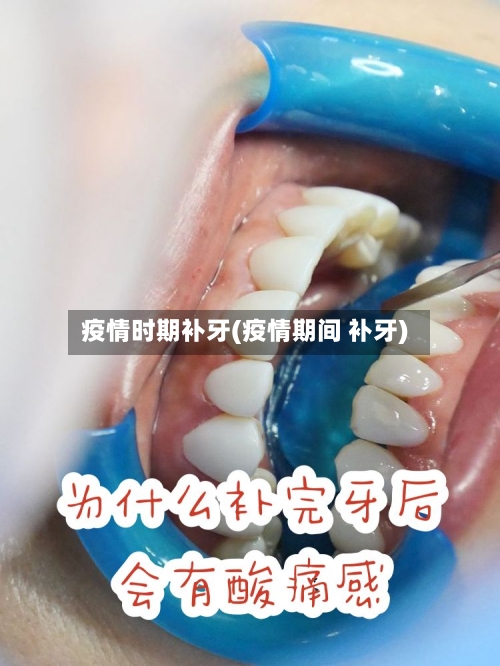 疫情时期补牙(疫情期间 补牙)