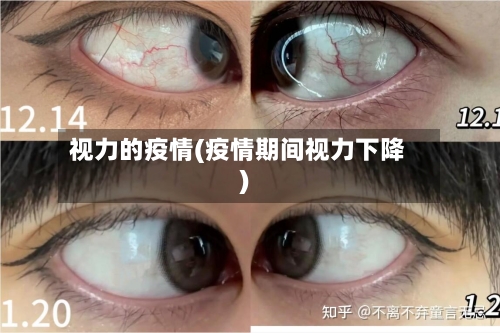 视力的疫情(疫情期间视力下降)