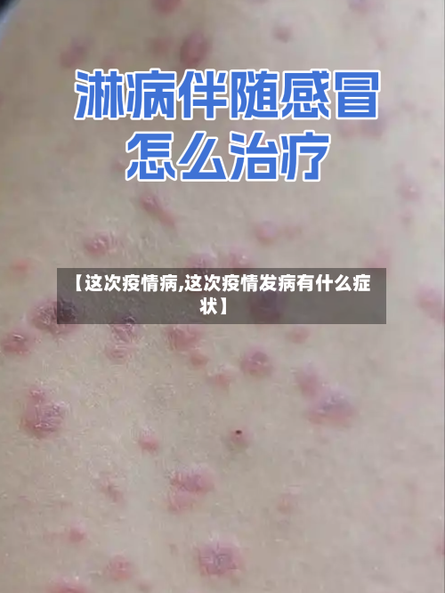 【这次疫情病,这次疫情发病有什么症状】