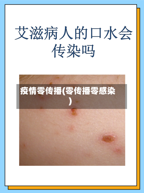 疫情零传播(零传播零感染)