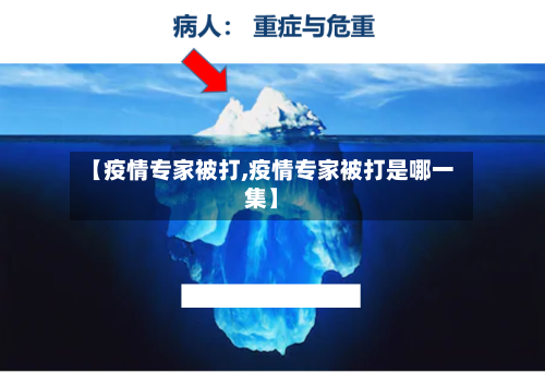 【疫情专家被打,疫情专家被打是哪一集】