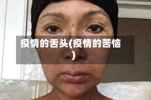 疫情的舌头(疫情的苦恼)